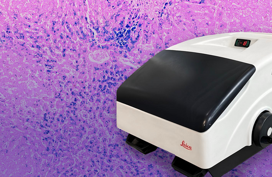 Biopsia por Congelación