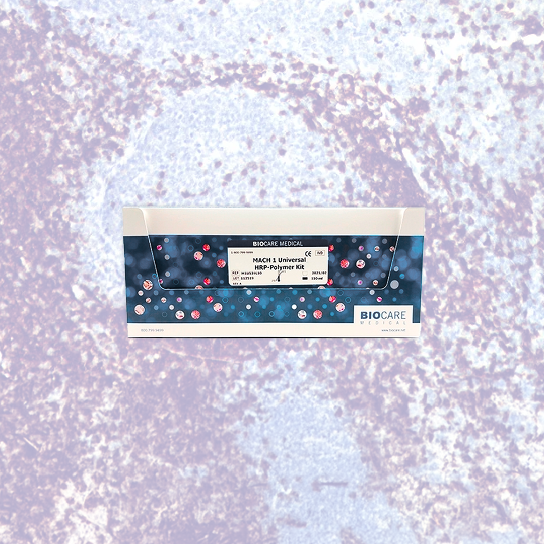 Inmunohistoquímica