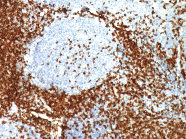 Inmunohistoquímica